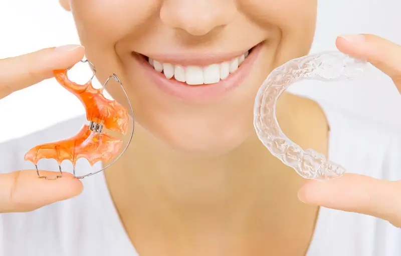 Aparat Invisalign